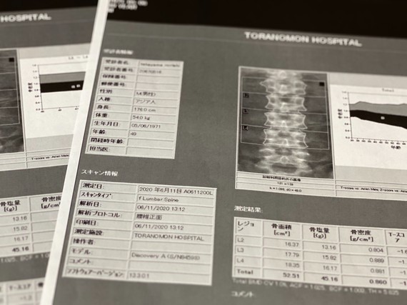 骨密度検査の結果