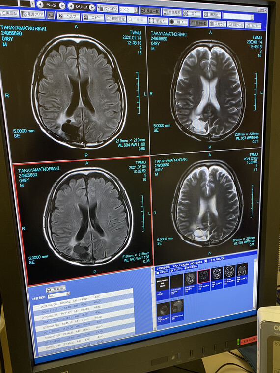 脳MRI202102-2