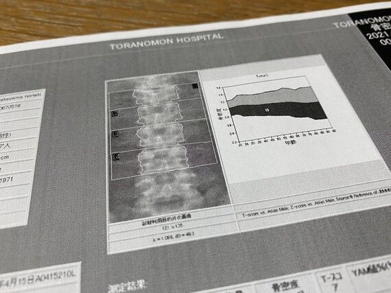 骨密度検査の結果