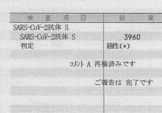 コロナウイルス 抗体検査結果